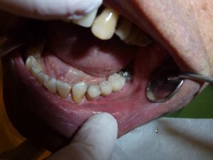 Cosmetic dentist procedures
